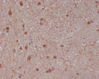 S100B/S100 Beta Rabbit Monoclonal Antibody