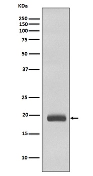 Anti-Caveolin-3 CAV3 Rabbit Monoclonal Antibody