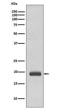 Caveolin-3 CAV3 Rabbit Monoclonal Antibody