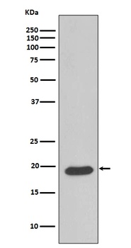 Anti-Caveolin-3 CAV3 Rabbit Monoclonal Antibody