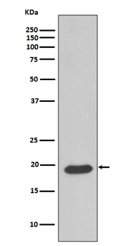 Caveolin-3 CAV3 Rabbit Monoclonal Antibody