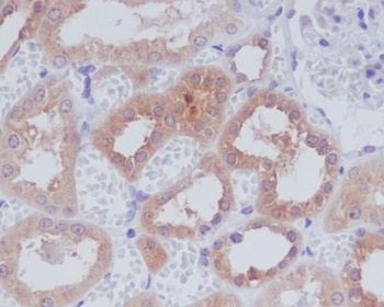 AMPK alpha 1 PRKAA1 Rabbit Monoclonal Antibody