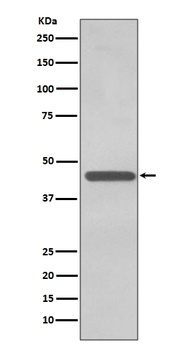 TDP43 TARDBP Rabbit Monoclonal Antibody