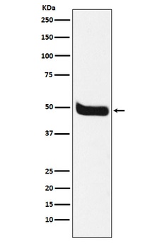 Anti-Neurokinin 1 Receptor Monoclonal Antibody