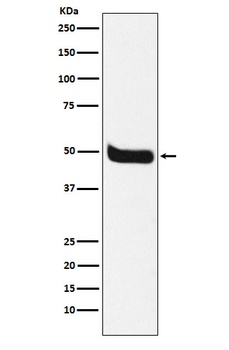 Neurokinin 1 Receptor Monoclonal Antibody