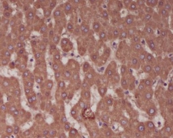 Alkaline Phosphatase ALPL Rabbit Monoclonal Antibody