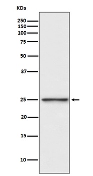 PGP9.5 Rabbit Monoclonal Antibody