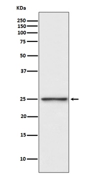 Anti-PGP9.5 Rabbit Monoclonal Antibody