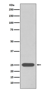 PGP9.5 UCHL1 Rabbit Monoclonal Antibody