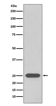Anti-PGP9.5 UCHL1 Rabbit Monoclonal Antibody