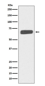 Collagen X COL10A1 Rabbit Monoclonal Antibody