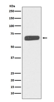 Anti-Collagen X COL10A1 Rabbit Monoclonal Antibody