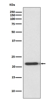 TIMP2 Rabbit Monoclonal Antibody
