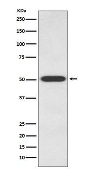 Endothelin B Receptor EDNRB Rabbit Monoclonal Antibody