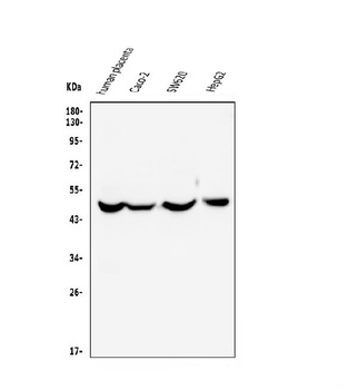 EDNRB Antibody (monoclonal, 15C3)