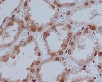 YB1 YBX1 Rabbit Monoclonal Antibody