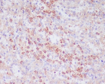 CD63 Rabbit Monoclonal Antibody