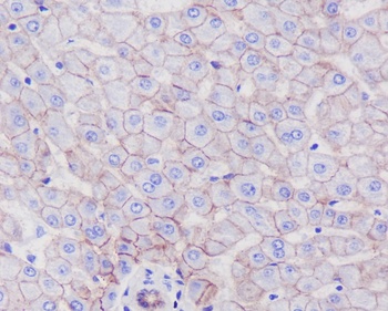 SCARB1/Sr Bi Rabbit Monoclonal Antibody