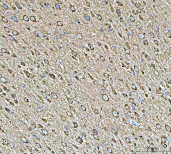 Anti-Hsp90 alpha + beta HSP90AA1 Rabbit Monoclonal Antibody