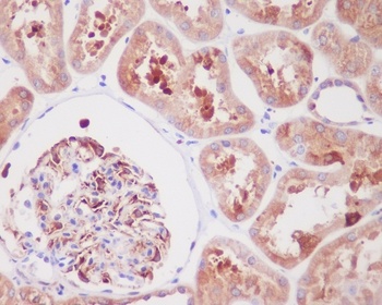 Anti-ARG1/Arginase 1 Rabbit Monoclonal Antibody
