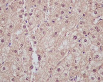 Liver Arginase ARG1 Rabbit Monoclonal Antibody