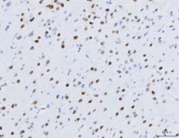 MEF2A+MEF2C Rabbit Monoclonal Antibody
