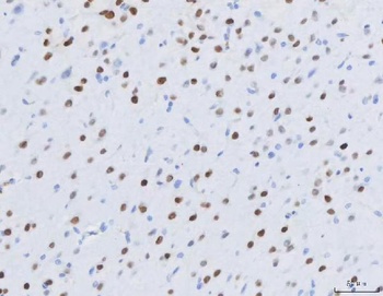 Anti-MEF2A+MEF2C Rabbit Monoclonal Antibody