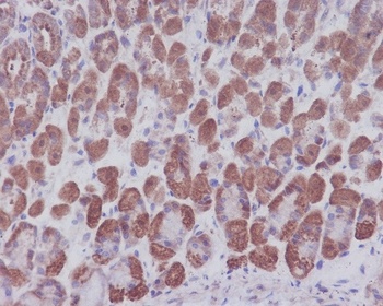 Anti-IKB alpha NFKBIA Rabbit Monoclonal Antibody