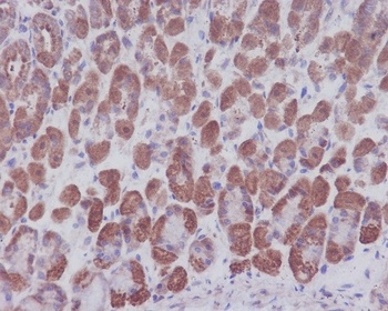 IKB alpha NFKBIA Rabbit Monoclonal Antibody