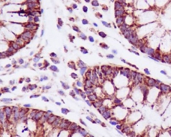 Anti-PBR TSPO Rabbit Monoclonal Antibody