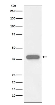 Anti-Troponin T TNNT2 Rabbit Monoclonal Antibody