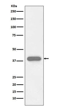 Troponin T TNNT2 Rabbit Monoclonal Antibody