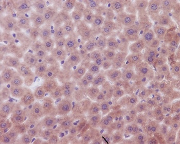 Anti-Bak BAK1 Rabbit Monoclonal Antibody