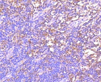 GCN2 EIF2AK4 Rabbit Monoclonal Antibody