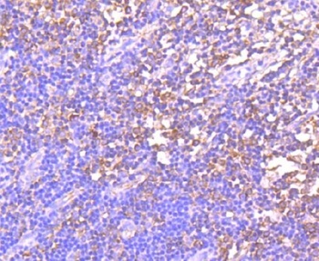 Anti-GCN2 EIF2AK4 Rabbit Monoclonal Antibody