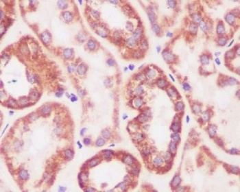 Anti-Prohibitin PHB Rabbit Monoclonal Antibody