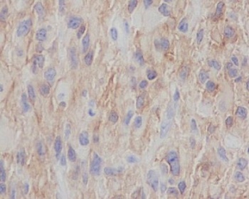 NGFR/P75 Rabbit Monoclonal Antibody