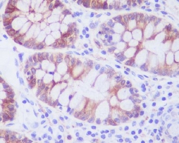 Anti-Stathmin 1 STMN1 Rabbit Monoclonal Antibody