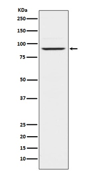 Prolactin Receptor Rabbit Monoclonal Antibody