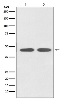 AGTR1 Rabbit Monoclonal Antibody