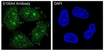Anti-S100A4 Rabbit Monoclonal Antibody