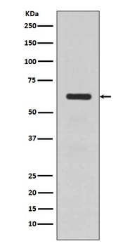 Anti-TGFBI/Beta Ig H3 Rabbit Monoclonal Antibody