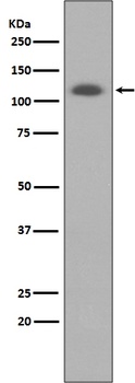Anti-ABCG1 Rabbit Monoclonal Antibody