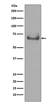 Lamin B Receptor LBR Rabbit Monoclonal Antibody