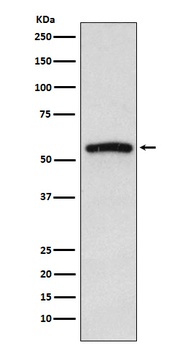IRAK4 Monoclonal Antibody