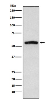 Anti-IRAK4 Monoclonal Antibody
