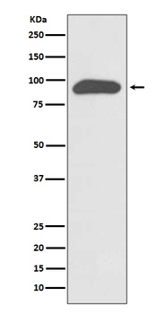 Anti-Chromogranin A CHGA Rabbit Monoclonal Antibody