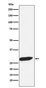 Anti-FHL1 Monoclonal Antibody