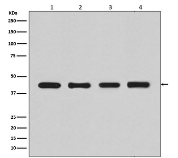 Anti-beta Actin ACTB Rabbit Monoclonal Antibody