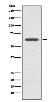 Glutaminase GLS Rabbit Monoclonal Antibody